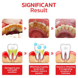 SP4 Ultra Whitening Probiotic Toothpaste